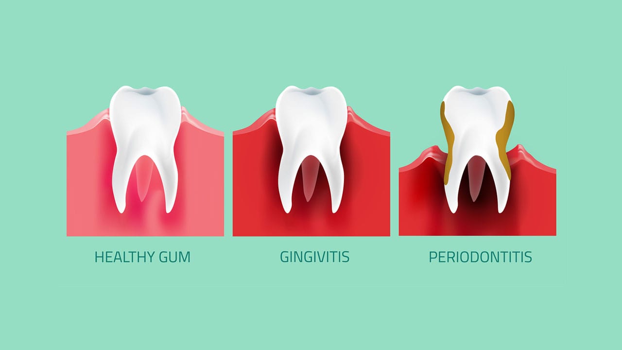 Top 3 Reasons Why You Should Visit Belfield Dental