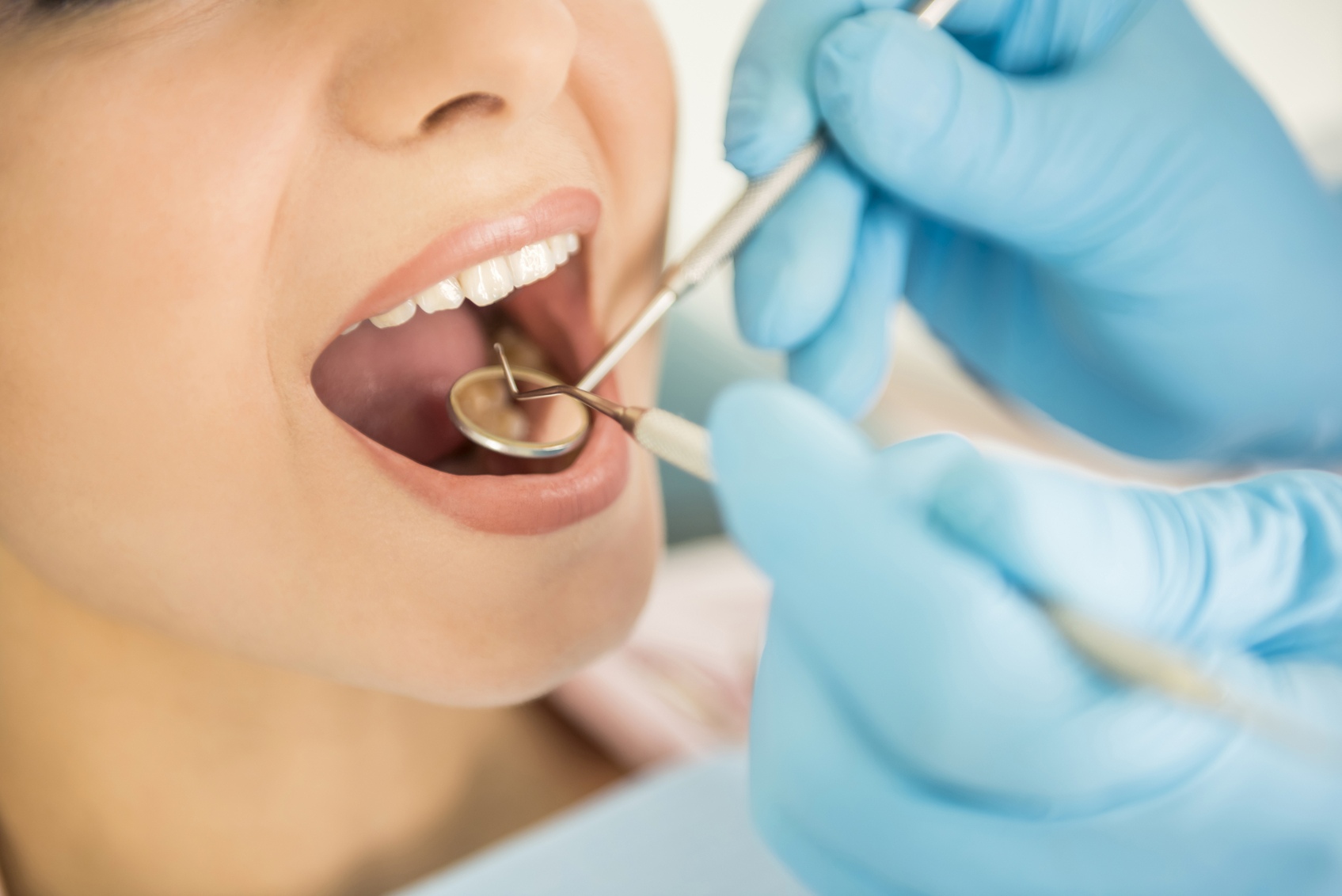 4 Things To Know About Dentist In Edmondson Park