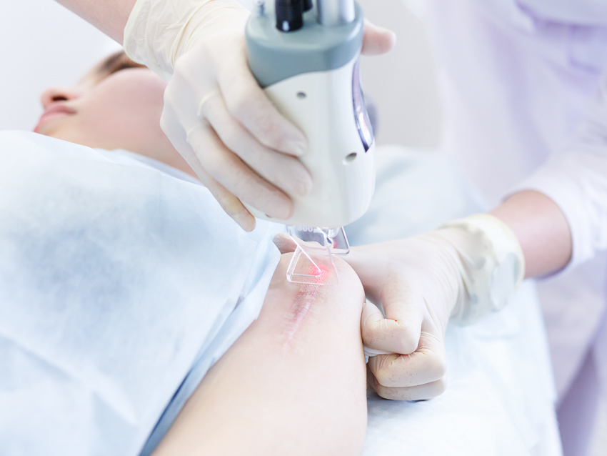 Understanding Pigmentation Removal In Macquarie Park: A Comprehensive Guide